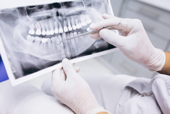 Radiologia dentale